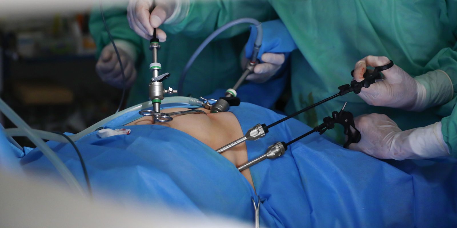 Advanced Laparoscopy for pregnancy in Nashik